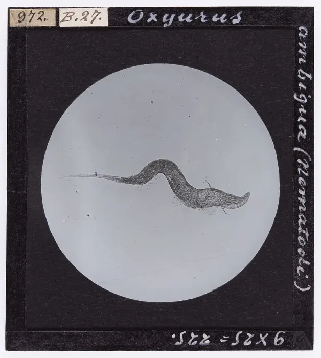 Impresión enmarcada : Micrografía de Oxyurus ambigua, un nematodo observado en detalle.