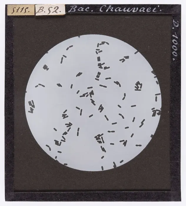 Stampa con cornice : Bacillo Chauvaei ingrandito al microscopio Stampa con cornice : Bacillo Chauvaei ingrandito al microscopio