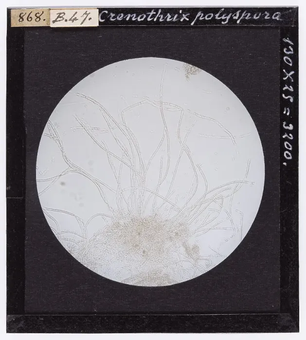 Stampa con cornice : Crenothrix polyspora ingrandita al microscopio
