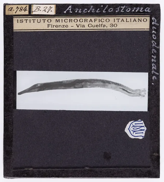 Stampa con cornice : Anchilostoma duodenale ingrandito al microscopio Stampa con cornice : Anchilostoma duodenale ingrandito al microscopio