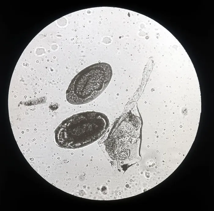 Stampa con cornice : Uova di Distoma Lanceolato (Trematodi) ingrandite al microscopio Stampa con cornice : Uova di Distoma Lanceolato (Trematodi) ingrandite al microscopio