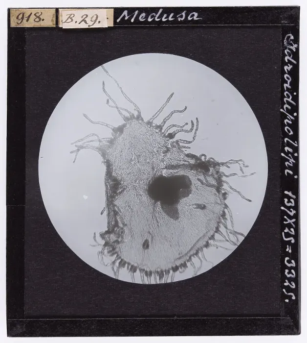 Impresión enmarcada : Medusa en microscopio.