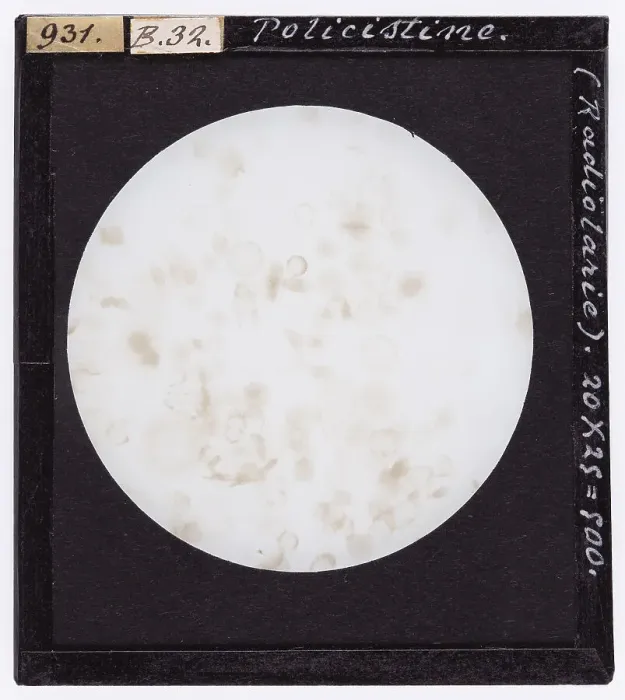 Stampa con cornice : Polycistine (Radiolarie) ingrandite al microscopio Stampa con cornice : Polycistine (Radiolarie) ingrandite al microscopio