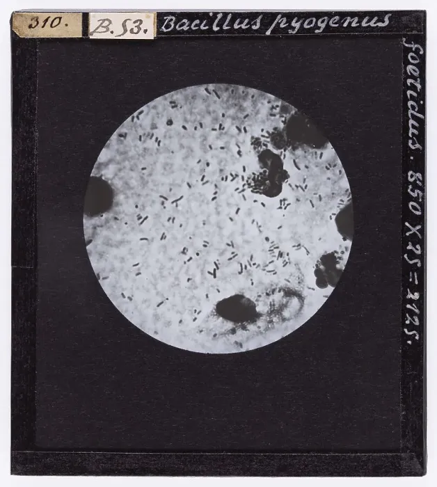 Stampa con cornice : Bacillus pyogenus foetidus ingrandito al microscopio