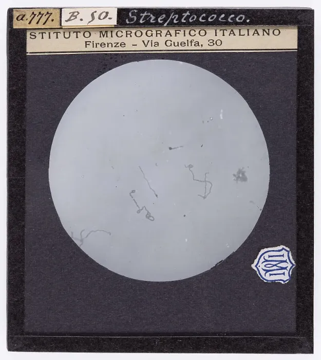 Stampa con cornice : Streptococco ingrandito al microscopio Stampa con cornice : Streptococco ingrandito al microscopio