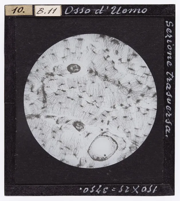 Stampa con cornice : Sezione trasversale di osso di un uomo ingrandito al microscopio