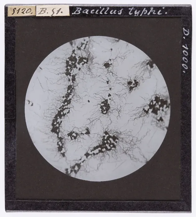 Stampa con cornice : Bacillo del Tifo ingrandito al microscopio Stampa con cornice : Bacillo del Tifo ingrandito al microscopio