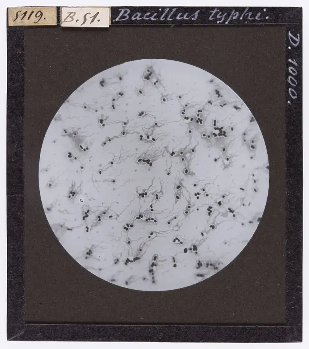 Impression encadrée : Bacille du typhus agrandi au microscope Impression encadrée : Bacille du typhus agrandi au microscope