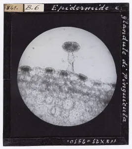 Microfotografia Stampe: Epidermide e glandule di Pinguicula ingrandite al microscopio