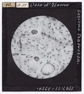 Microfotografia Stampe: Sezione trasversale di osso di un uomo ingrandito al microscopio