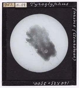 Microfotografia Stampe: Tyroglyphus farine (Acarinae) ingrandito al microscopio