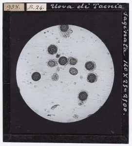Microfotografia Stampe: Uova di Taenia saginata (Cestodi) ingrandite al microscopio