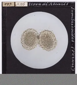 Microfotografia Stampe: Uova di Ascaris lumbricoides (Vermi) ingrandite al microscopio