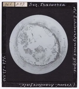 Microfotografia Stampe: Sezione trasversale di Echinorhyncus gigas (Vermi-Acantocefali) ingrandito al microscopio