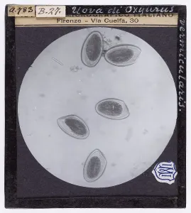 Microfotografia Stampe: Uova di Oxyurus vermicularis ingrandite al microscopio