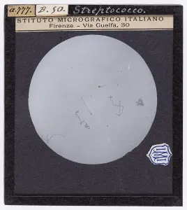 Microfotografia Stampe: Streptococco ingrandito al microscopio