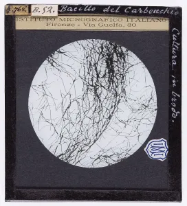 Microfotografia Stampe: Bacillo del Carbonchio presente in un brodo di coltura. Ingrandimento microscopico
