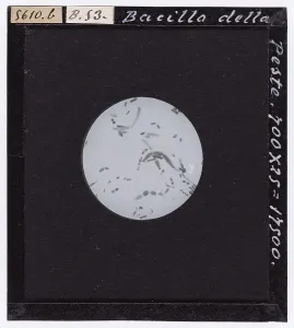 Microfotografia Stampe: Ingrandimento microscopico del Bacillo della peste