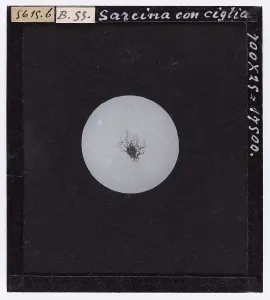 Microfotografia Stampe: Sarcina con ciglia ingrandita al microscopio