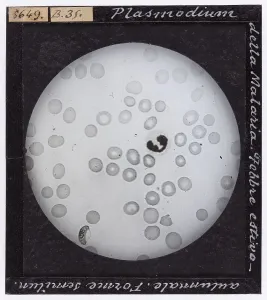 Tendenza: Plasmodium della malaria ingrandito al microscopio