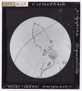 Microfotografia Stampe: Crenothrix polyspora proveniente da un acquedotto fiorentino ingrandita al microscopio