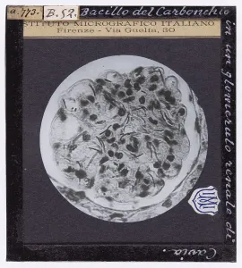 Microfotografia Stampe: Bacillo del Carbonchio annidato in un glomerulo renale di cavia ingrandito al microscopio