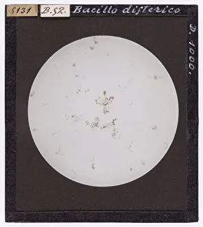 Bacille du diphthérie grossi par microscope.