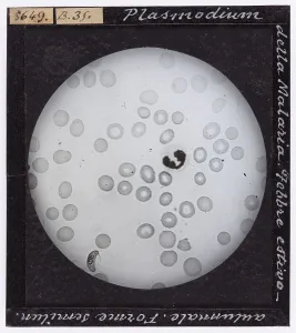Microphotographie dune forme semilunaire de Plasmodium, parasite responsable de la malaria.