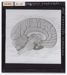 Section verticale du cerveau humain agrandie au microscope (Microphotographie)